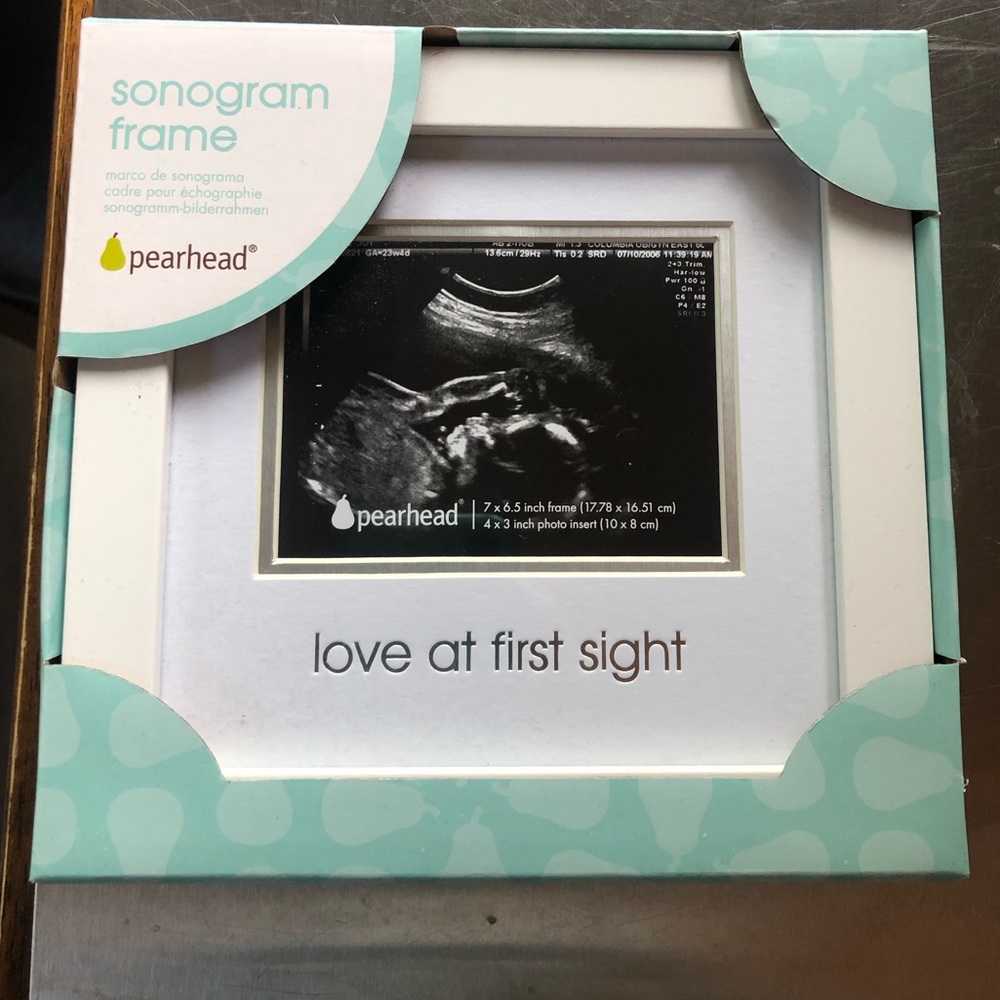 Sonogram Frame